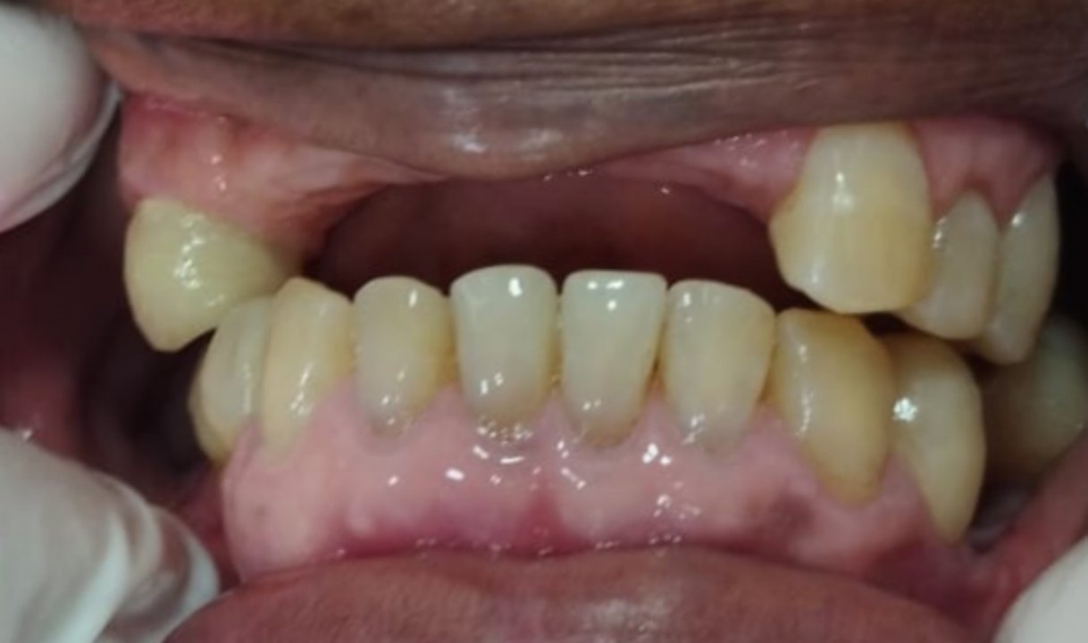 Vista dental inicial del caso clínico 01