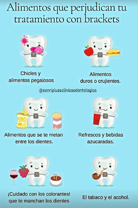 Guía visual de alimentos que conviene evitar durante un tratamiento con brackets.